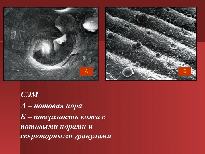 СЭМ А – потовая пора Б – поверхность кожи с