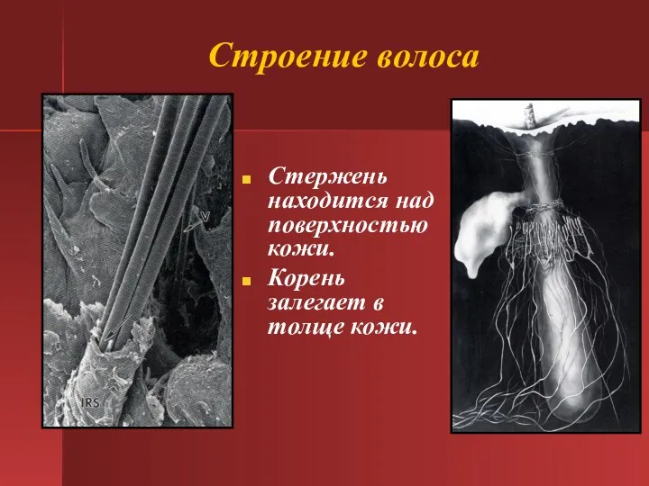 Строение волоса Стержень находится над поверхностью кожи. Корень залегает в толще кожи.