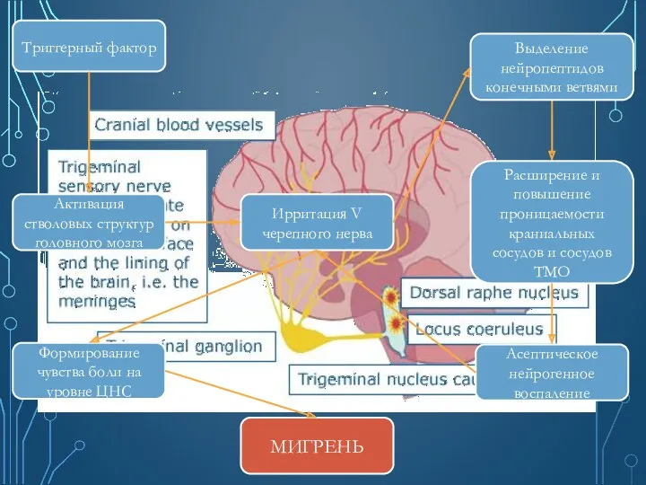 Триггерный фактор Активация стволовых структур головного мозга Ирритация V черепного