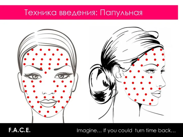 ADVANCED REVITALIZATION & TREATMENT F.A.C.E. Imagine… If you could turn time back… Техника введения: Папульная