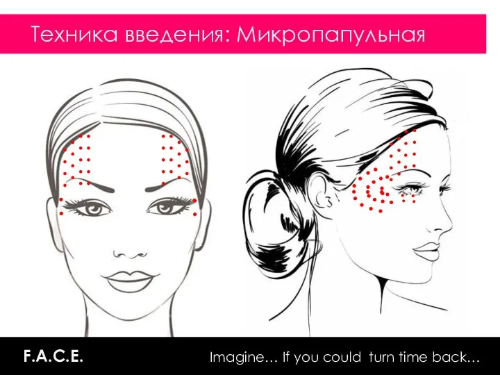 ADVANCED REVITALIZATION & TREATMENT F.A.C.E. Imagine… If you could turn time back… Техника введения: Микропапульная