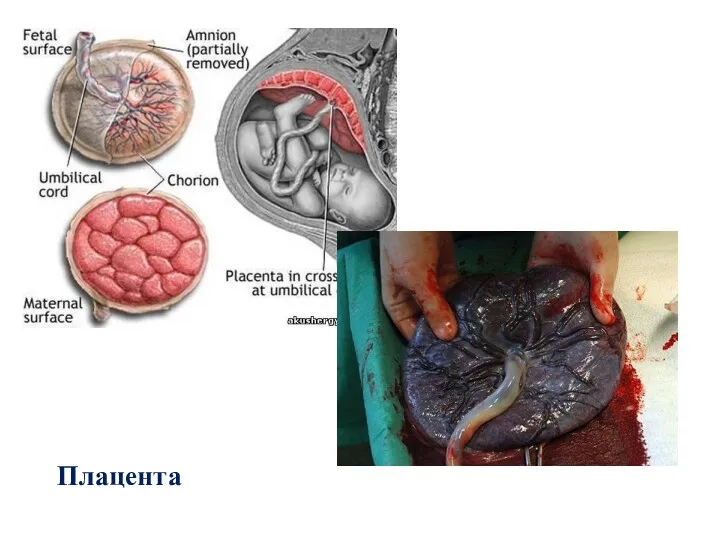 Плацента
