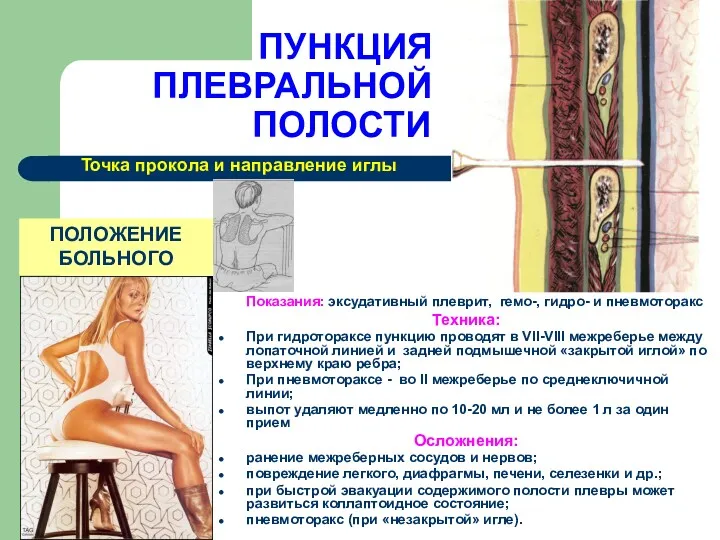 ПУНКЦИЯ ПЛЕВРАЛЬНОЙ ПОЛОСТИ Показания: эксудативный плеврит, гемо-, гидро- и пневмоторакс