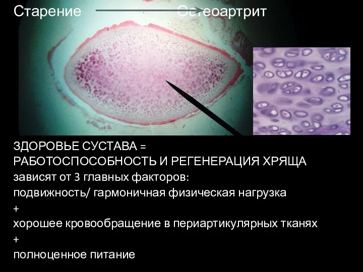 ЗДОРОВЬЕ СУСТАВА = РАБОТОСПОСОБНОСТЬ И РЕГЕНЕРАЦИЯ ХРЯЩА зависят от 3