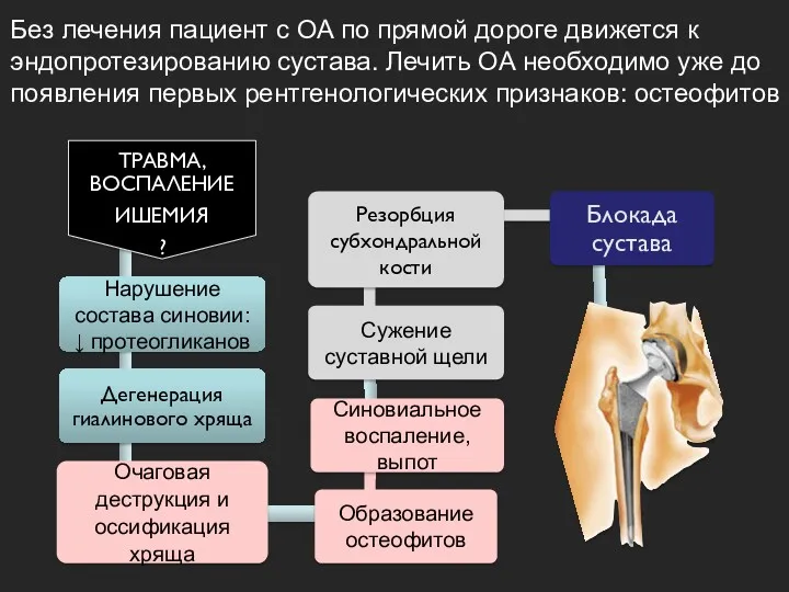 Без лечения пациент с ОА по прямой дороге движется к