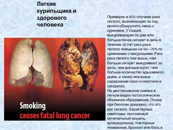 Легкие курильщика и здорового человека Примерно в 85% случаев рака