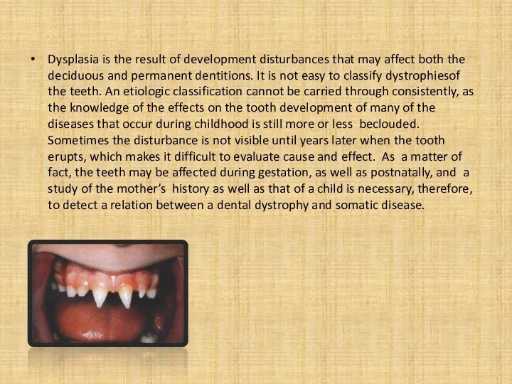 Dysplasia is the result of development disturbances that may affect both the deciduous