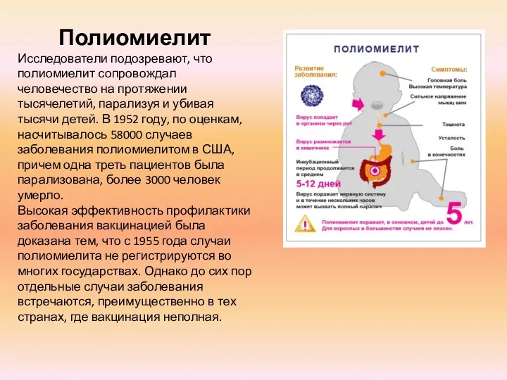 Полиомиелит Исследователи подозревают, что полиомиелит сопровождал человечество на протяжении тысячелетий,