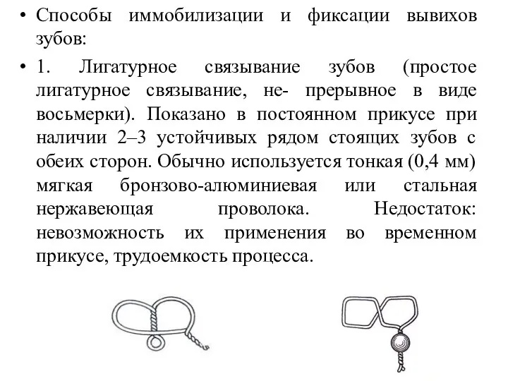 Способы иммобилизации и фиксации вывихов зубов: 1. Лигатурное связывание зубов