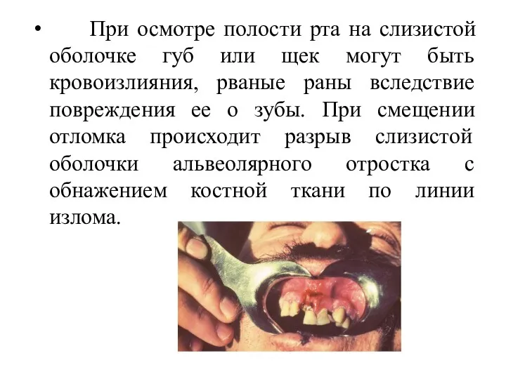 При осмотре полости рта на слизистой оболочке губ или щек