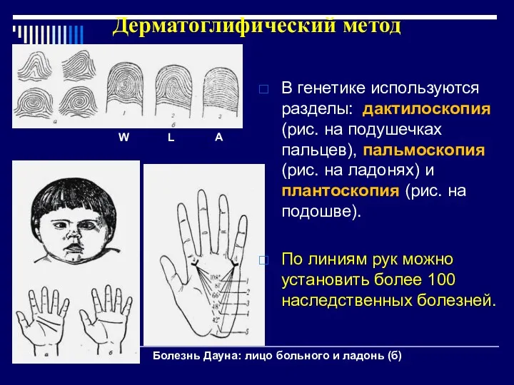 Дерматоглифический метод В генетике используются разделы: дактилоскопия (рис. на подушечках