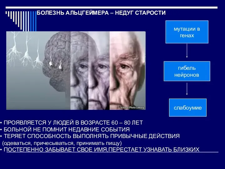 БОЛЕЗНЬ АЛЬЦГЕЙМЕРА – НЕДУГ СТАРОСТИ ПРОЯВЛЯЕТСЯ У ЛЮДЕЙ В ВОЗРАСТЕ