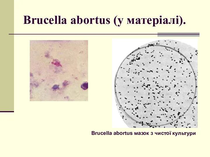 Brucella abortus (у матеріалі). Brucella abortus мазок з чистої культури