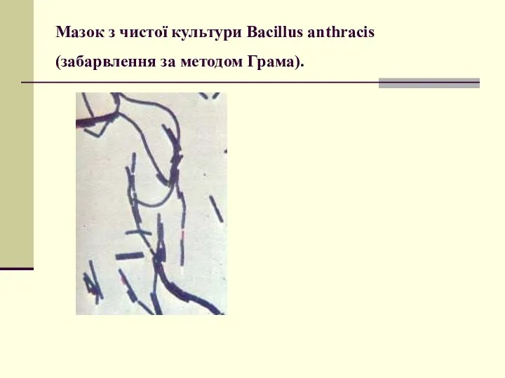 Мазок з чистої культури Bacillus anthracis (забарвлення за методом Грама).