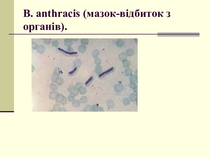 B. anthracis (мазок-відбиток з органів).