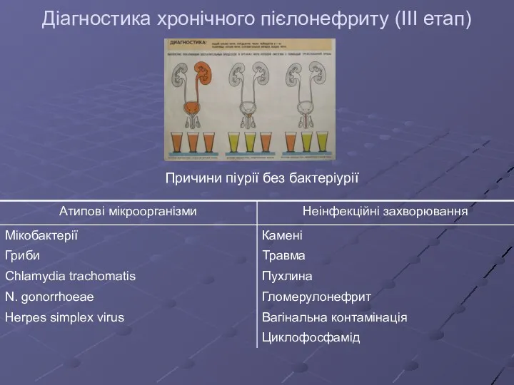 Діагностика хронічного пієлонефриту (III етап) Причини піурії без бактеріурії