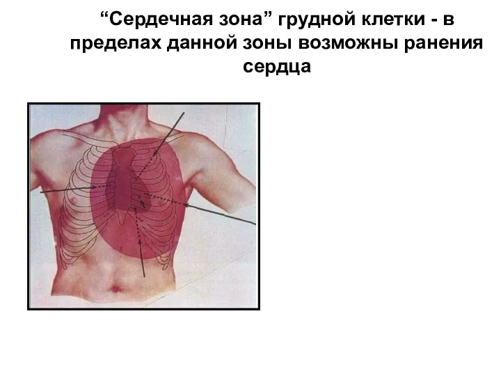 “Сердечная зона” грудной клетки - в пределах данной зоны возможны