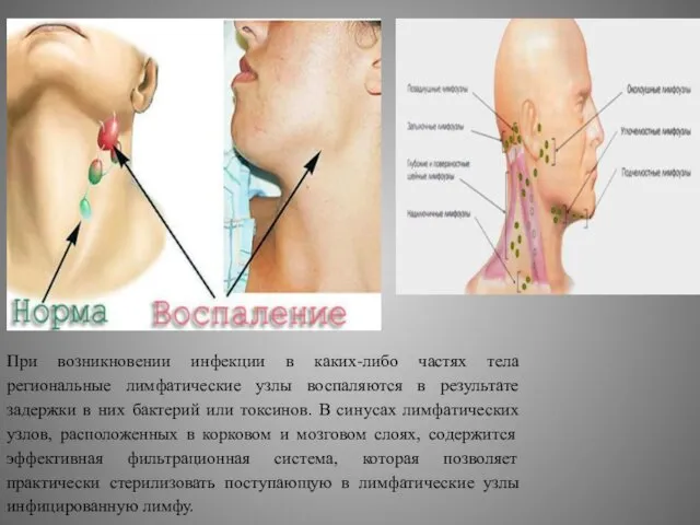При возникновении инфекции в каких-либо частях тела региональные лимфатические узлы