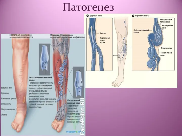 Патогенез