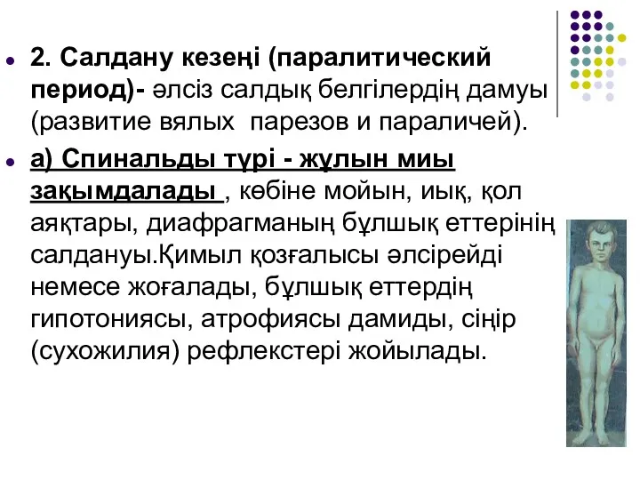 2. Салдану кезеңі (паралитический период)- әлсіз салдық белгілердің дамуы (развитие