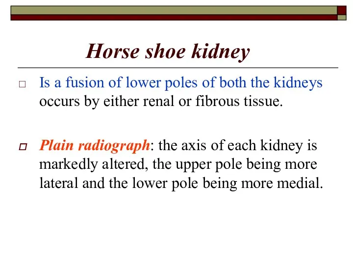 Horse shoe kidney Is a fusion of lower poles of