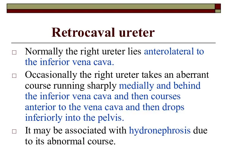 Retrocaval ureter Normally the right ureter lies anterolateral to the