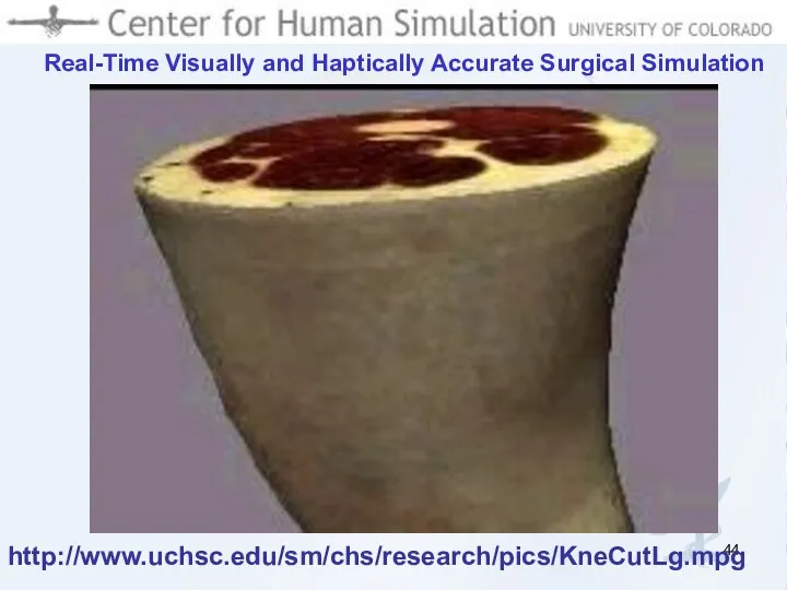 Real-Time Visually and Haptically Accurate Surgical Simulation http://www.uchsc.edu/sm/chs/research/pics/KneCutLg.mpg