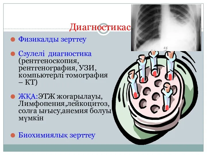 Диагностикасы Физикалды зерттеу Сәулелі диагностика (рентгеноскопия, рентгенография, УЗИ, компьютерлі томография