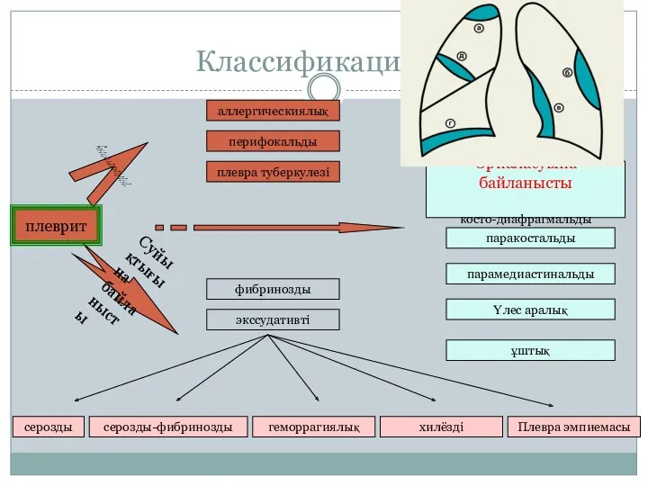 Классификациясы Патогенезіне байланысты: Суйықтығына байланысты аллергическиялық перифокальды плевра туберкулезі фибринозды