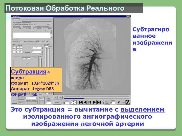 Потоковая Обработка Реального Времени Субтракция 4 кадра формат 1024*1024*8b Аппарат Legasy DRS фирма