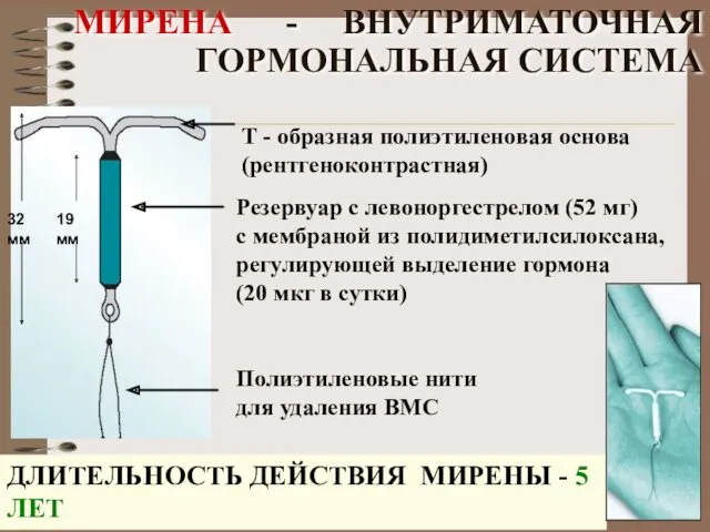 МИРЕНА - ВНУТРИМАТОЧНАЯ ГОРМОНАЛЬНАЯ СИСТЕМА Т - образная полиэтиленовая основа