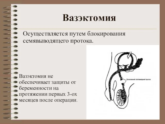 Вазэктомия Вазэктомия не обеспечивает защиты от беременности на протяжении первых