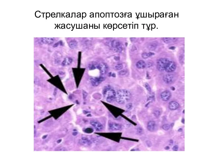 Стрелкалар апоптозға ұшыраған жасушаны көрсетіп тұр.