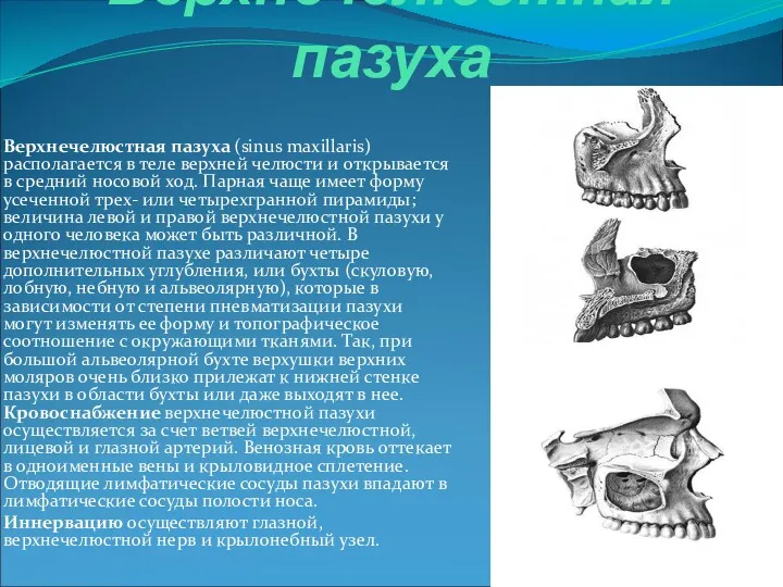 Верхнечелюстная пазуха Верхнечелюстная пазуха (sinus maxillaris) располагается в теле верхней