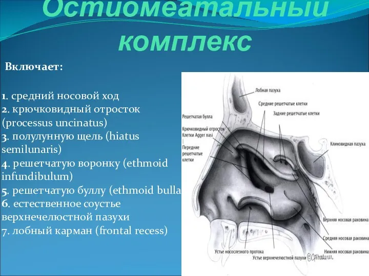 Остиомеатальный комплекс Включает: 1. средний носовой ход 2. крючковидный отросток