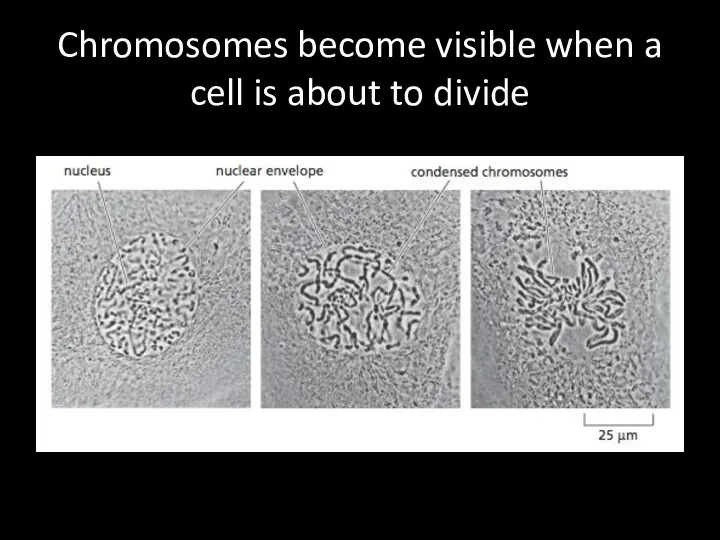 Chromosomes become visible when a cell is about to divide