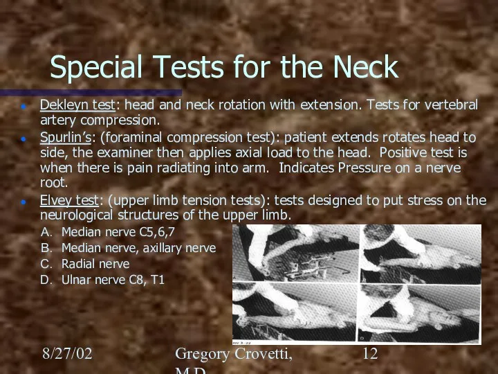 8/27/02 Gregory Crovetti, M.D. Special Tests for the Neck Dekleyn
