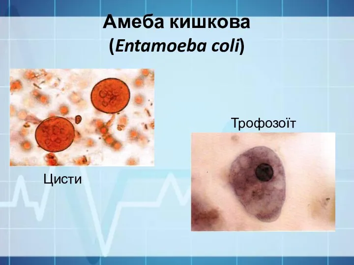Амеба кишкова (Entamoeba coli) Цисти Трофозоїт