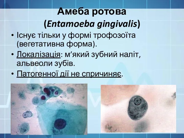 Амеба ротова (Entamoeba gingivalis) Існує тільки у формі трофозоїта (вегетативна