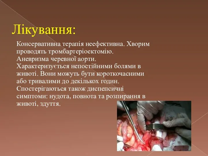 Консервативна терапія неефективна. Хворим проводять тромбартеріоектомію. Аневризма черевної аорти. Характеризується