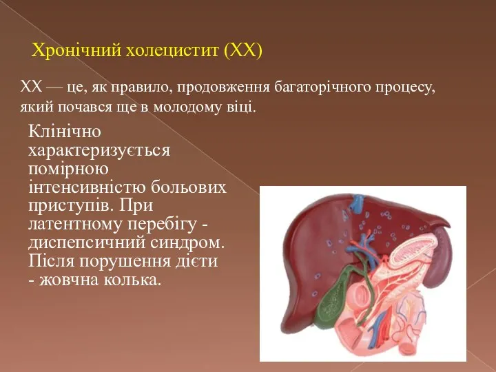 Хронічний холецистит (XX) XX — це, як правило, продовження багаторічного процесу, який почався