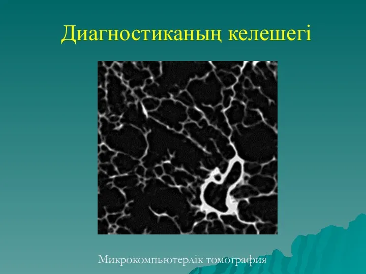 Диагностиканың келешегі Микрокомпьютерлік томография