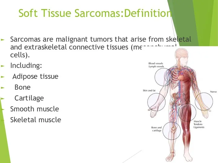 Soft Tissue Sarcomas:Definition Sarcomas are malignant tumors that arise from