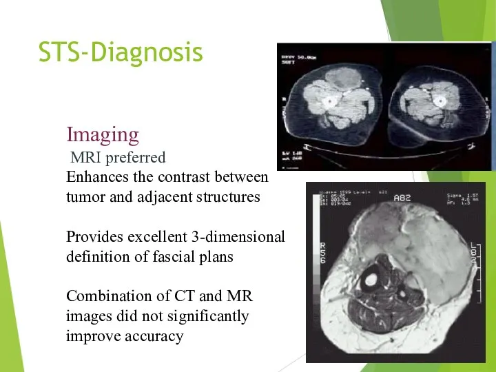 STS-Diagnosis Imaging MRI preferred Enhances the contrast between tumor and