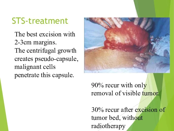 STS-treatment The best excision with 2-3cm margins. The centrifugal growth