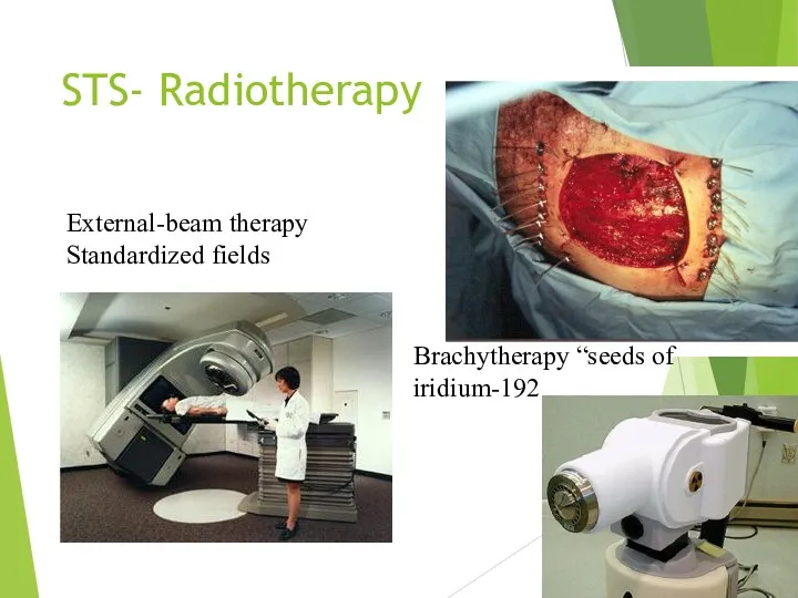 STS- Radiotherapy Brachytherapy “seeds of iridium-192 External-beam therapy Standardized fields