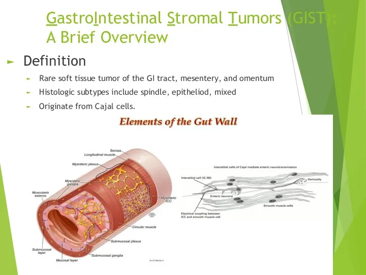 GastroIntestinal Stromal Tumors (GIST): A Brief Overview Definition Rare soft