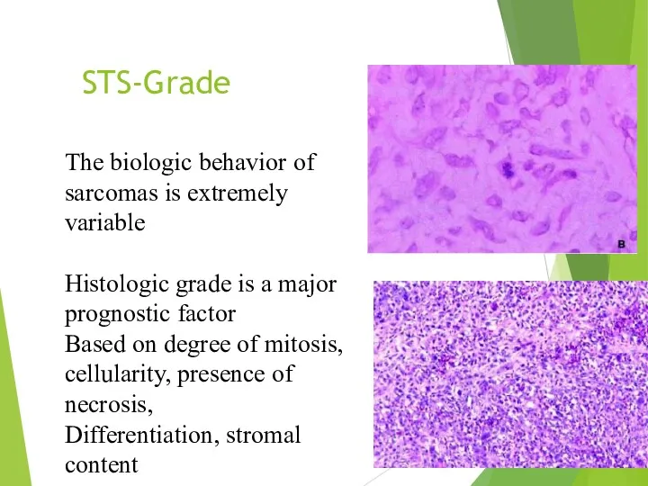 STS-Grade The biologic behavior of sarcomas is extremely variable Histologic