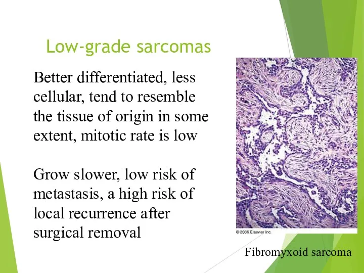 Low-grade sarcomas Fibromyxoid sarcoma Better differentiated, less cellular, tend to