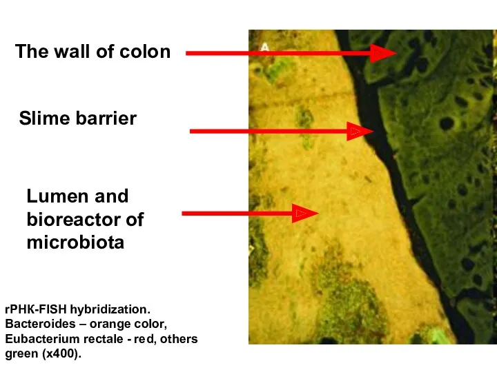 rРНК-FISH hybridization. Bacteroides – orange color, Eubacterium rectale - red,